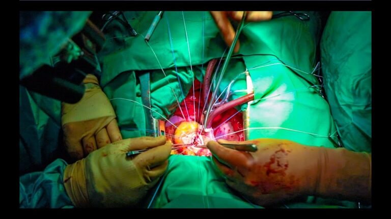 Open Heart Surgery: Aortic Valve Replacement from a Medical Student’s Perspective