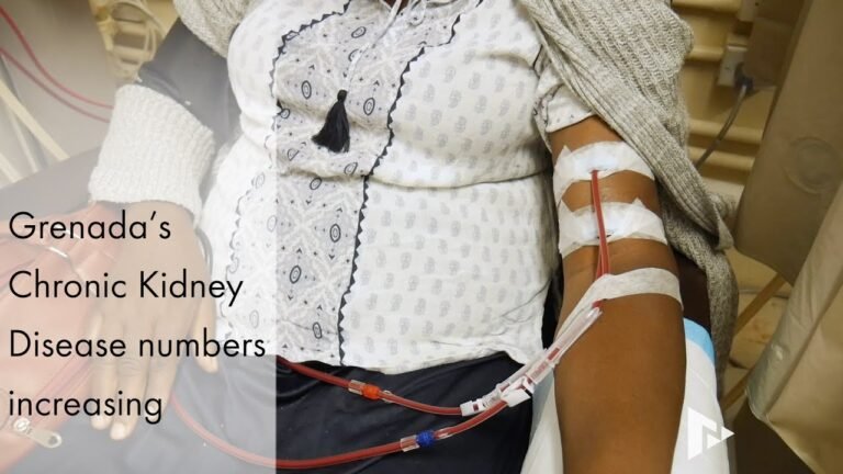 Grenada’s Chronic Kidney Disease numbers increasing